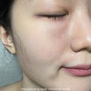 마곡역 피부관리 루아 에스테틱 브이업 하이푸 2500샷 리프팅 윤곽관리 후기