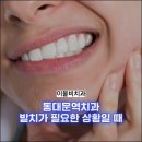 이물비치과의료생활협동조합 이물비치과의원 네이버블로그