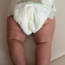 부산아동병원 | 4개월 영유아검진 6개월차 방문 후기 / 부산 남구 아동병원 다리주름 비대칭 의심