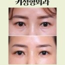 키성형외과의원 이미지