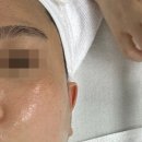 제이엔케어