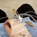 독립문약국 | 요즘의 나: 복부CT (췌장 미세낭종, 간 미세낭종), 헬리코박터균 제균 중