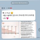 내돈내산 무보형물 코성형 코끝성형 복코교정 코끝연골묶기 당일 후기