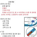 비타민 B12수치가 낮을 경우 치매의 원인이 될수 있습니다 ​ 이미지
