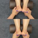밸런스힐체형교정센터