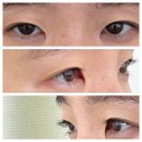 헤이브로우 눈썹&속눈썹 | 경기 수원 솔리드브로우 눈썹&속눈썹 속눈썹펌 후기 수원페이가능 샵