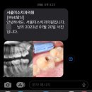 크레앙스 | [용산/서울미소치과의원]어금니 충치 신경치료 후 지르코니아 크라운 씌우기