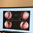라경찬한의원 | [내돈내산] 최악의 비염인 라경찬한의원 1개월 차 후기