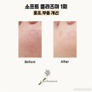 더스무스스킨케어&왁싱 네이버블로그