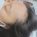 금강제화 경산대리점 | 경산 여자헤어라인문신 전후사진후기