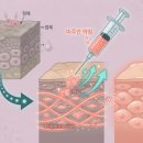 미주광택