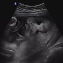 미사린 산후조리원 이미지