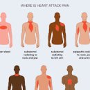 심장마비 전조증상 자세히 알아보기 이미지