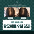 동탄대로1길 | 동탄탈모병원후기로 알 수 있는 것 3가지