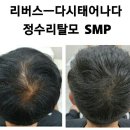 탈모응급실 리버스-다시태어나다 이미지