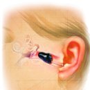 스타키보청기강남센터 이미지