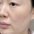 소프트나노 | 수부지 장벽크림 추천! 피부과 전문의가 만든 주닥 인텐스 모이스트 B5 소프트 크림 내돈내산 후기