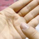 중앙 메디케어 이미지