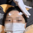 슈헤어라인 - 달서구 감삼동 | [더스무스왁싱 광주봉선점] 예신관리 헤어라인왁싱 받고온 후기!