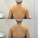 핌에스테틱 인천 웨딩케어 관리 후기