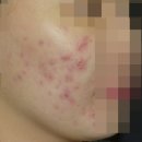 이동관한의원 | 안산지루성피부염한의원 한의학 솔루션은