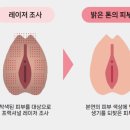 르웰유여성의원 네이버블로그