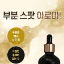 오일스팟 이미지