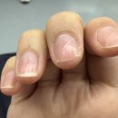 오늘도맑음네일도맑음 | 필리핀 바기오 단기 어학연수4_마지막주 일상