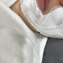 황수란피부과의원 | 당산역피부과 촉촉하고 쫀득한 피부 회복 슈링크 600샷 리프팅 솔직후기