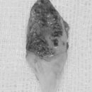 청주으뜸치과의원 이미지