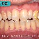 한올치과기공소 이미지