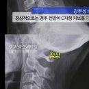 내 목뼈 볼 사람 이미지