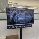 횡성치과의원 네이버블로그