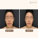 오브마곡 이미지