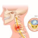 수유다나은정형외과의원 | 번동정형외과 목디스크, 어깨·팔저림까지 이어질 수 있습니다