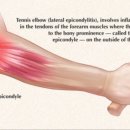 주 PT GYM 이미지