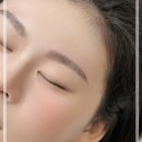 홍대 눈썹문신제거 후기 자연눈썹 복구성공 모그브로우 추천