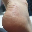 메디위 | 내돈내산 메디위 파라핀 베스WE-7000<MEDIWE> 9개월 사용한 솔직한 리얼 후기