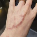 임신 28주 임신성 수포 임산부 보습제 추천 후기