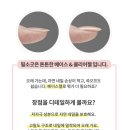 소굿네일
