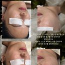지에스(GS)25양정퀸즈점 | [물든 에스테틱 왁싱] 연제구 양정역근처 피부관리 추천