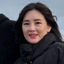 신사역성형외과 무보형코수술 내돈내산 상담후기