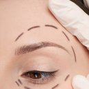 비즈성형외과의원 이미지