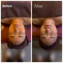 대정치과의원 | 계산동 피부관리, 나우리 자연치유센터, 에어젯 윤곽관리 후기