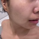 노브랜드 대전관저점 | 얼굴 윤곽관리, 대전 끌리매 관저점 솔직 후기