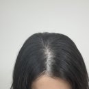 돌콩이네 - 49951 | 여성 탈모샴푸 내돈내산 모다모다 돌콩 엑소좀 샴푸 정수리 후기