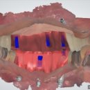 더디자인치과기공소 이미지