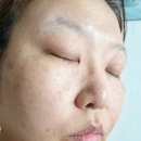 P-7510 | 티트리패드 블랑디바의 릴리프 티트리 케어패드 진정패드로 좋아요.