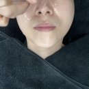 이벨 | 천안 피부관리 성성동 피부관리 블랙헤드 이벨 크라이오 블랙헤드 관리 후기