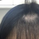 아토컷트 이미지